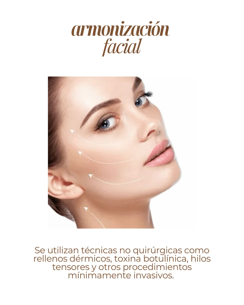 Lifting facial sin cirugía