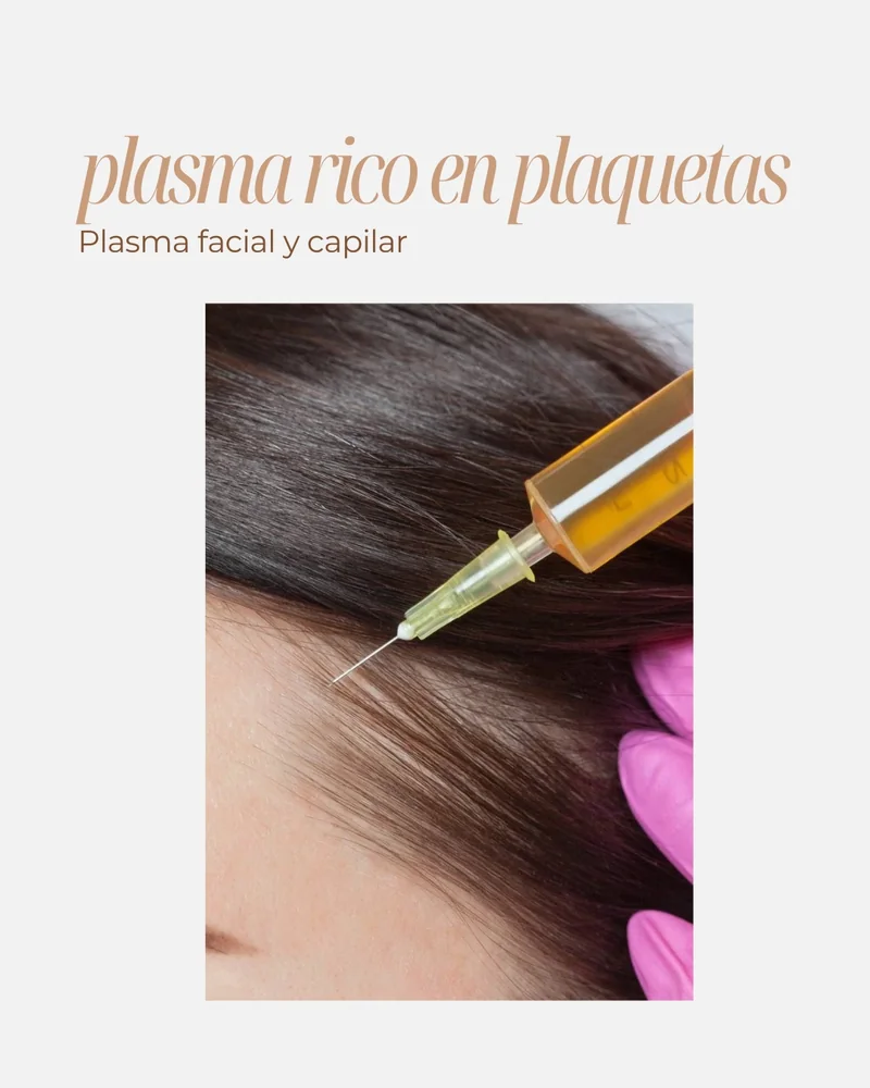 Plasma rico en plaquetas PRP