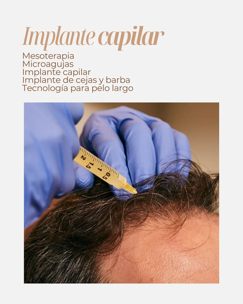 Terapia e implante capilar