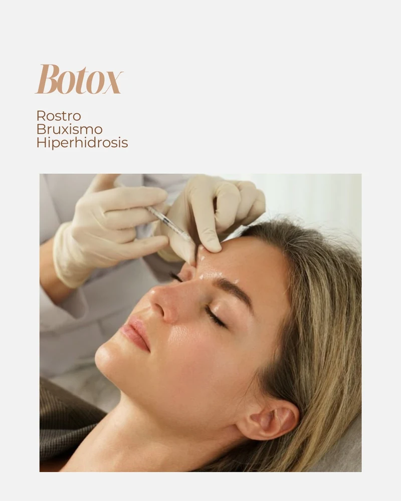 Aplicación de toxina botulínica